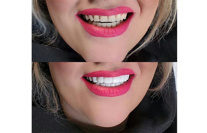 سفارش اسنپ اسمایل
