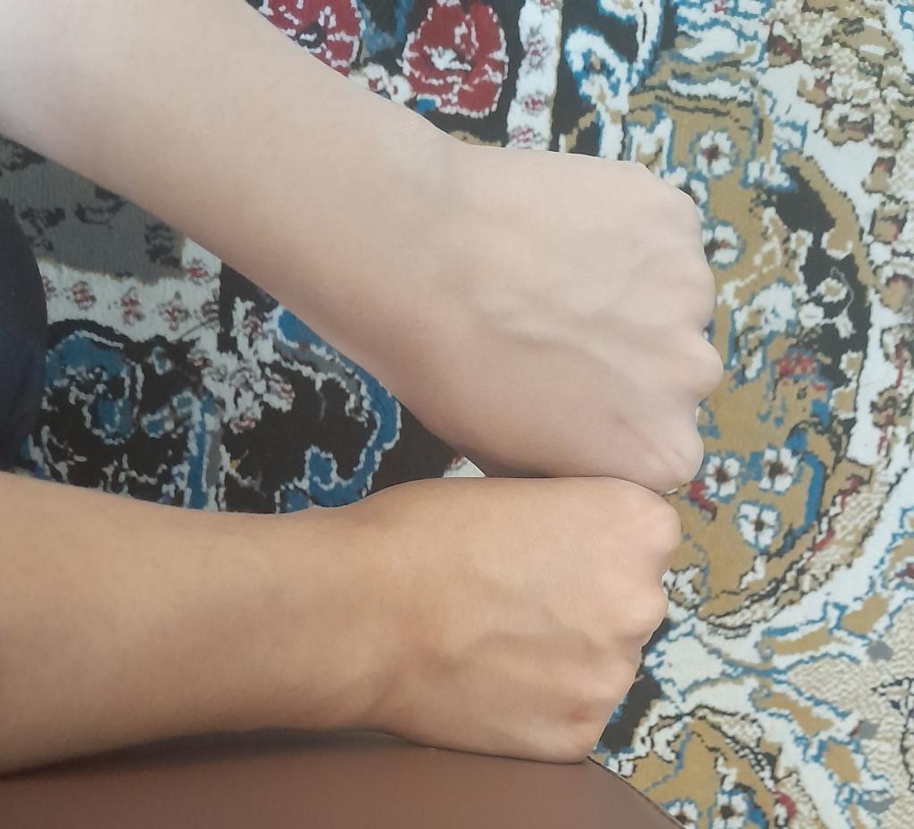 عکس کرم ووکس
