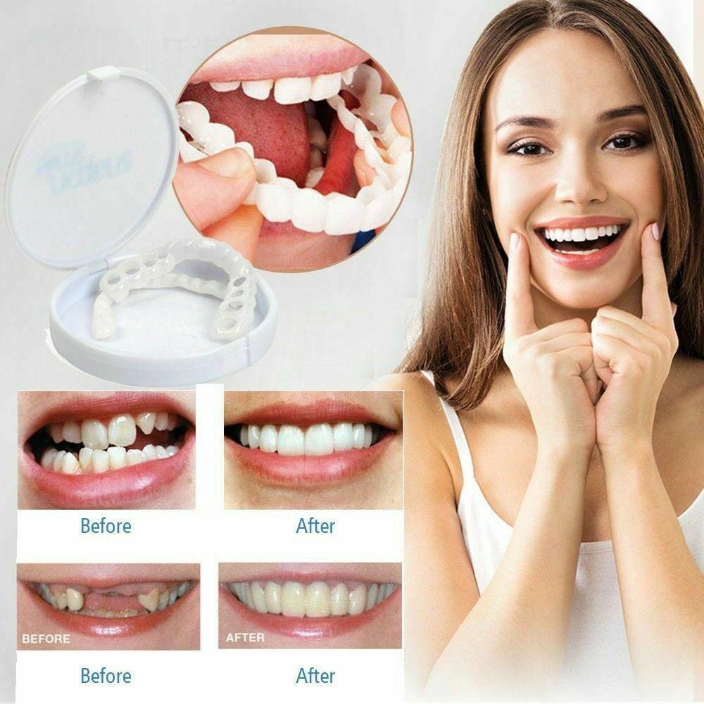 قیمت لمینت متحرک دندان در داروخانه