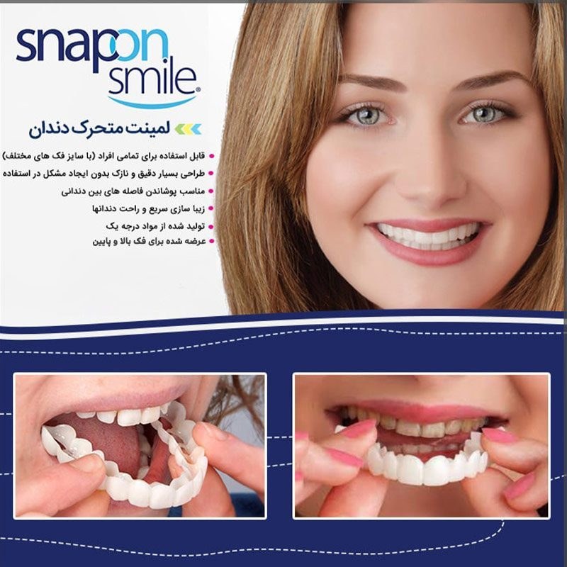 خرید لمینت متحرک دندان پرداخت درب منزل [اصل✅️] +آموزش